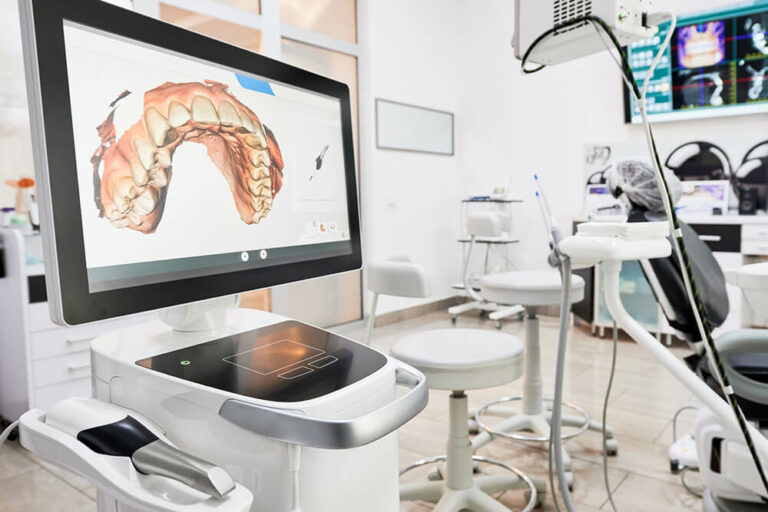 image of a cerec scanner screen