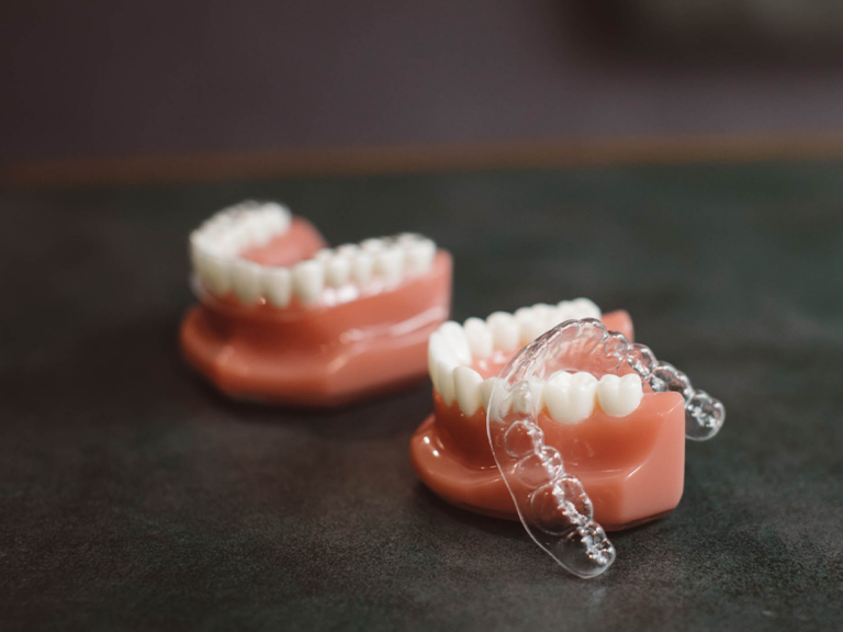 image of Invisalign resting on fake teeth