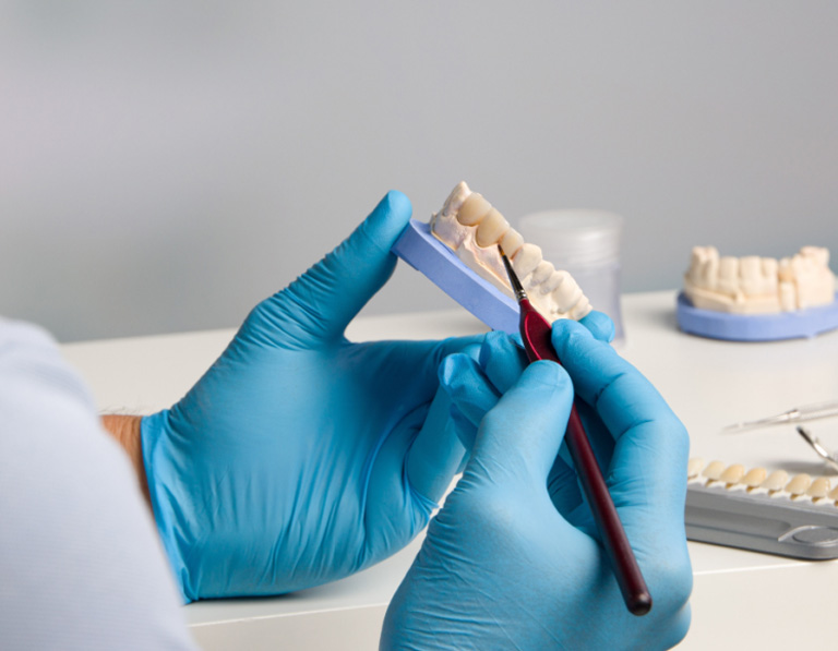 How to care for dental crowns after CEREC treatment in Orange Grove, CA at Orange Grove Family Dentistry