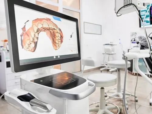 CEREC dental scanner and milling machine in Orange, CA at Orange Grove Family Dentistry