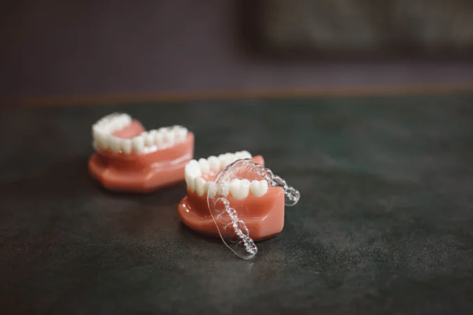 Clear Aligners
