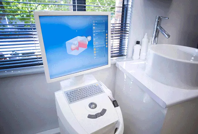 iTero Digital Dental Scanner in Orange, CA at Orange Grove Family Dentistry